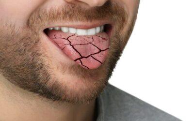 ¿Qué es la xerostomía?