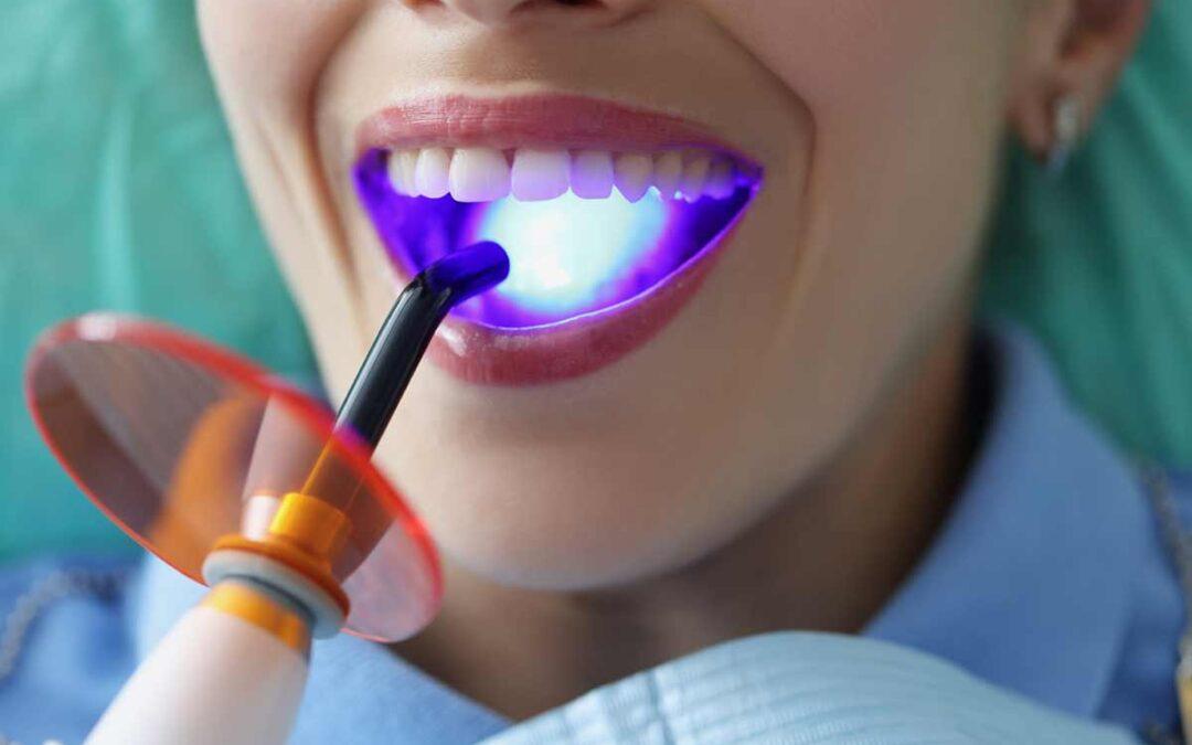 Blanqueamiento dental: técnicas, cuidados y resultados