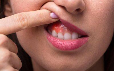 Tratamiento de encías sangrantes en Durango